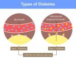 diabetes-y-sue-o-el-efecto-del-sue-o-en-el-riesgo-de-diabetes